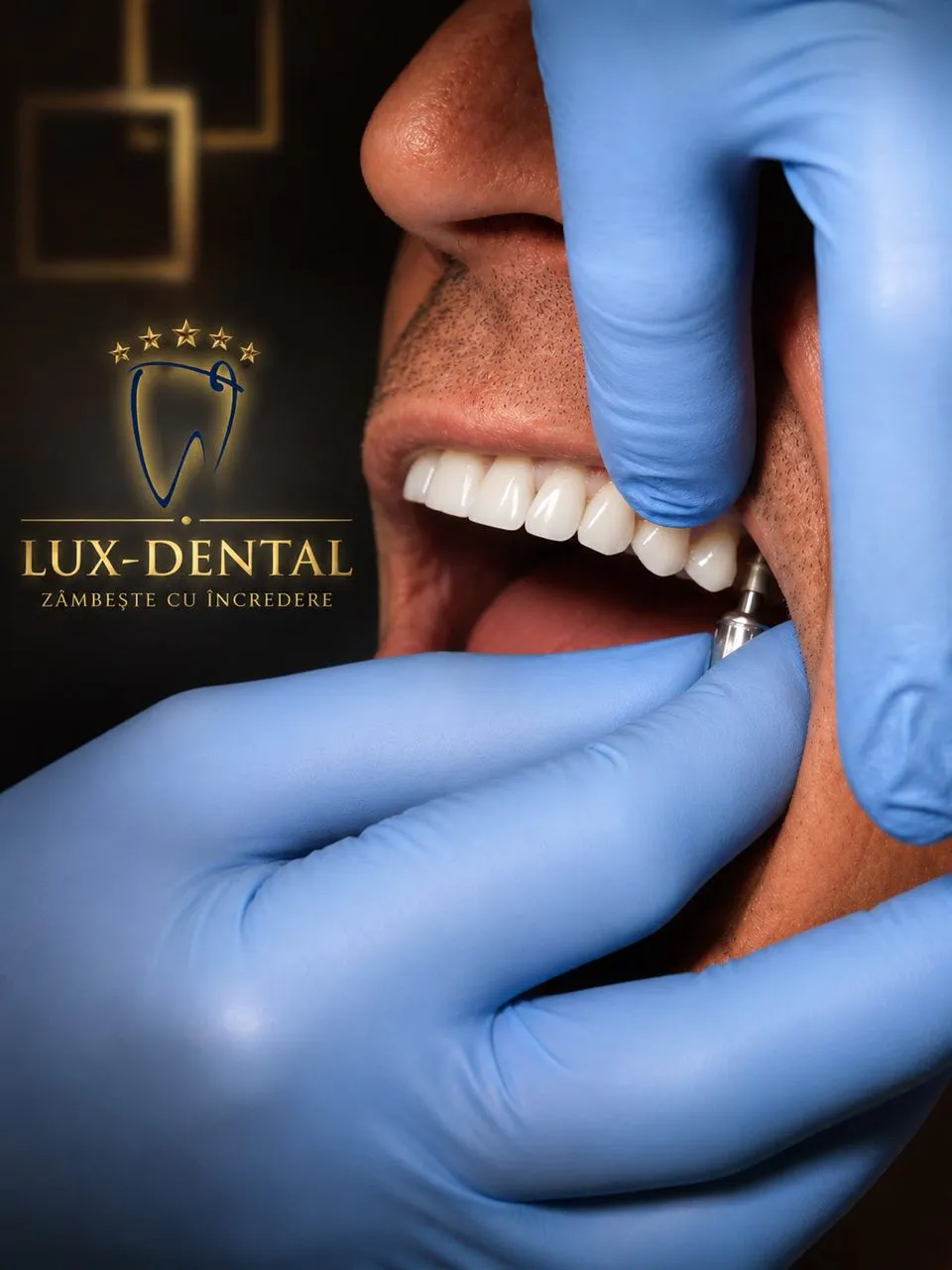 Implanturi dentare DIO – Coreea